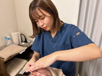 だいち鍼灸接骨院 札幌豊平店/リフトアップ美容鍼灸