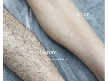 ハリウッドブロウリフト ワクシー 表参道店(HOLLYWOOD BROW LIFT WAXYYY.)/メンズ脱毛