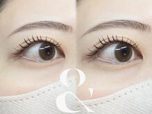 エステ屋/&Healthy アンドヘルシー