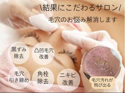 エミニー(EMINY)の写真