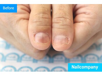 ネイルカンパニー/