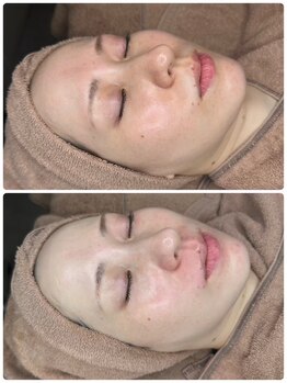 ビューティーサロンエイト(Beauty Salon8)/ワントーン明るいお肌へ