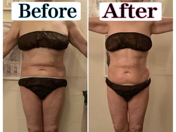 トータルビューティーサロン 凛/60代でも痩せる