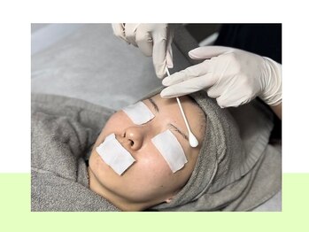 スキンラボ ドットシキブ 厚木海老名店(skinlabo .sikibu)/美肌改善オーダーピーリング