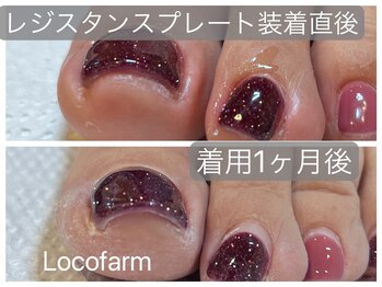 ロコ ファーム(loco farm)/レジスタンスプレート着用