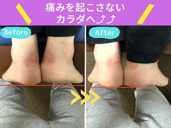 京都中丸整体カイロプラクティック/脚の長さ