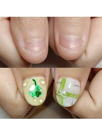 深爪矯正/ネイルDesignを楽しむ