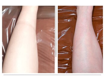 ひぺりかむ/【浮腫みには代謝アップで卒業】