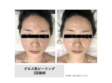 モイ(Moi’e)/毛穴・シワ・ハリ・ツヤ肌