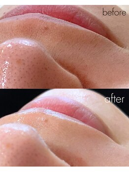 ビジ(biji)/見違える口周りへ