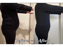 ヨサパーク ディアナ(YOSA PARK Diana)/ビフォーアフター