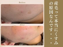 ベラノーブル(bella noble)/お高いエステではなく、定期的な