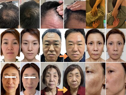 天使のしずくの写真