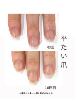 最強ネイルケア