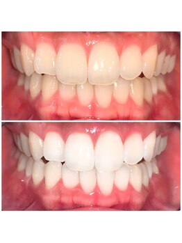 ライトビューティー 池袋店(LightBeauty)/症例写真