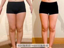 アンジー(Angie)/太ももスッキリ！