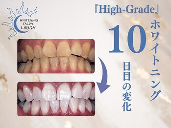 ラフ(LAUGH)/【審・美・白】 ホワイトニング