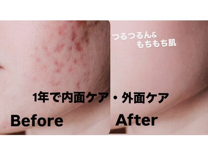 イリゼ(IRISE)の写真