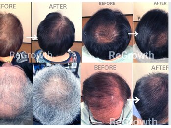 髪顔体/育毛促進マッサージ結果！