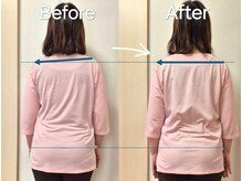 スノー シャイン(SNOW SHINE)の雰囲気（肩の高さが整い、全身の歪みがすっきり姿勢改善♪印象が違います）