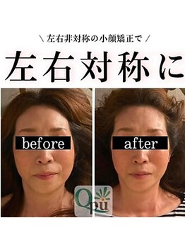 キュープ 鹿児島伊集院店(Qpu)/