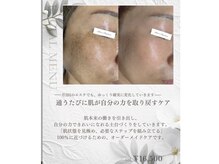 ミーラブ 鹿児島(miilove)の雰囲気(お肌が綺麗になったことをお客様と一緒に喜べる時間が幸せです)