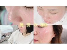 マイ フェア レディ(MY FAIR LADY)/松ヤニパック