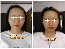 燕健友館健和堂/小顔矯正