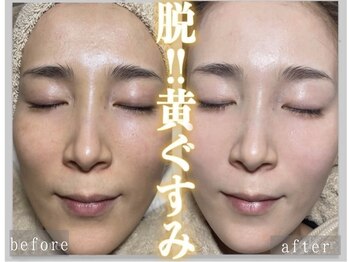 ドクターヴィー 高知(DrVi)/ビフォーアフター