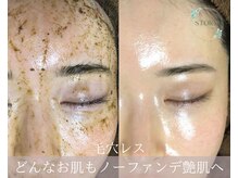 ストーリー(STORY)