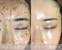 ストーリー(STORY)