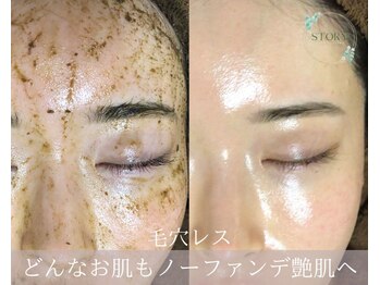 ストーリー(STORY)