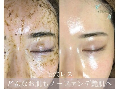 ストーリー(STORY)の写真