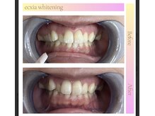 エクシアホワイト 平岸駅前店/