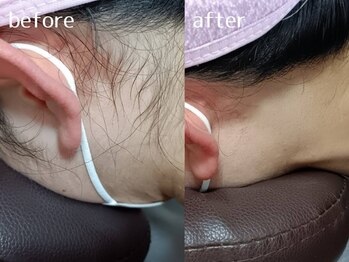 エンプレス(empress)/うなじシェービング