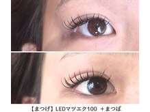 ヴィラアンドテラス(Villa×terrace)/LEDマツエク100 ＋ マツパ