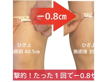 ベンザイ 新潟店(BENZAI)/１回でマイナス0、8センチ！