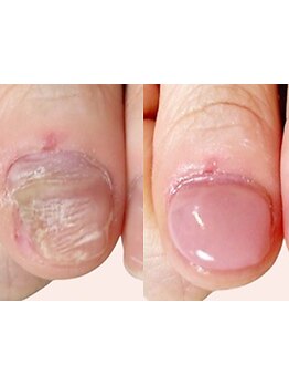 長さ出しのできるサロン