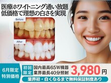 スマイルホワイト 赤羽店