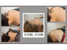 ノフ 恵比寿(noff)の雰囲気（リピーター多数!!《小顔へ近道》美容鍼×首肩鍼◎）