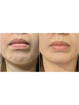 お肌をきれいにしたい