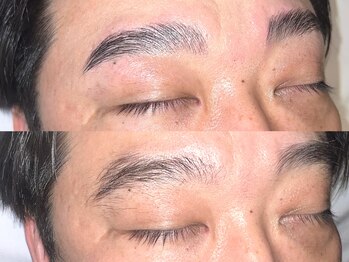 キャンバス 初台(CANVAS)/- Men's HBL - Before/After