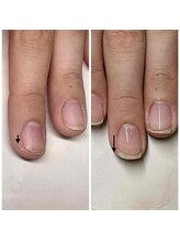 コティ(cotty)/自爪育成☆途中経過