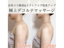 コアコア 伊丹フェイシャルエステ(core core.)の雰囲気（大人気オプション！よりスッキリ♪巻き肩・猫背・印象も変わる♪）