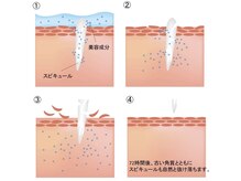 ティアラ(TIARA)/人幹細胞スピキュール