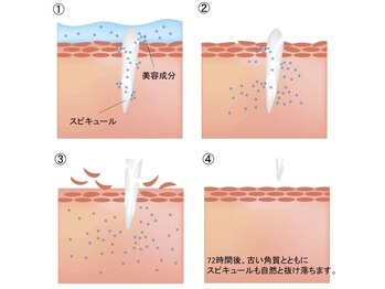 ティアラ(TIARA)/人幹細胞スピキュール