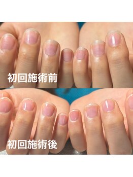 スティラ(Stila)/自爪育成/深爪育成/ジェルネイル