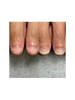 爪の悩みを解消できる（ケア含む）