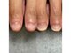 トレフル(Trefle)の写真/【深爪ケアなら実績No.1の"Trefle"へ！】かみ癖・むしり癖・深爪を美爪にする明石唯一の自爪育成専門店◎
