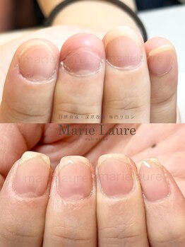 マリーロール 淀屋橋本店(Marie Laure)/自爪育成/深爪矯正/ネイルケア